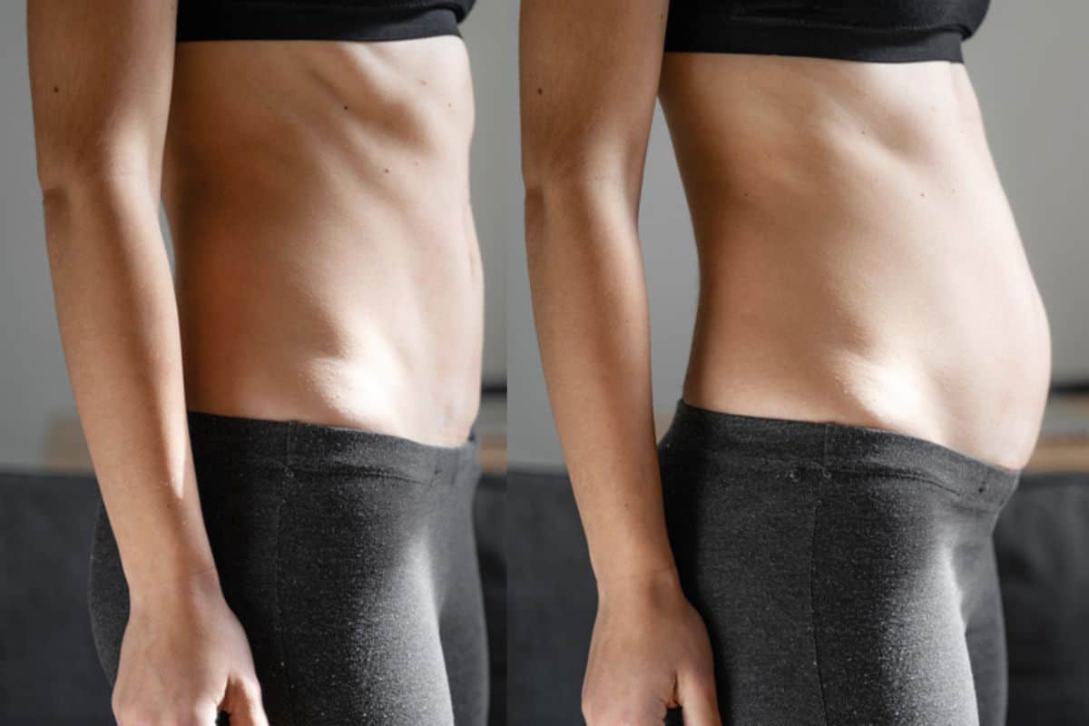 How long does diastasis recti take to improve Mansfield?