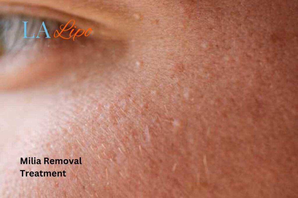 When It’s Time to See a Professional Mansfield?