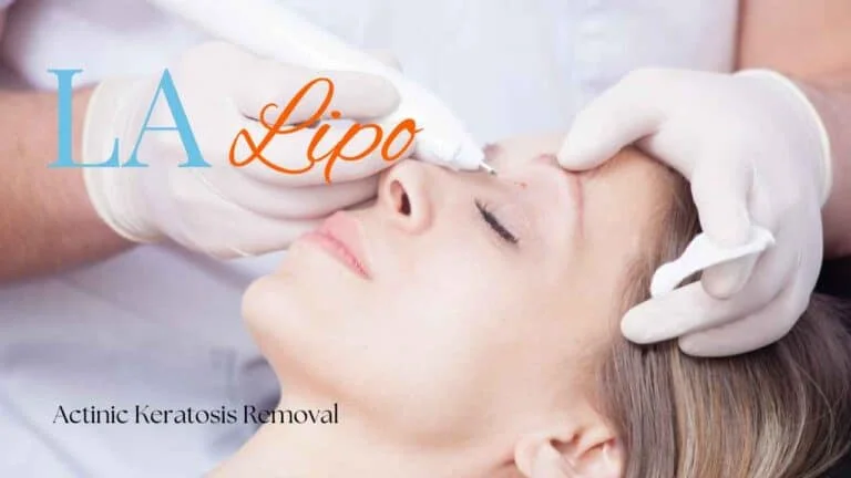 Woman receiving Actinic Keratosis Removal Treatment Mansfield