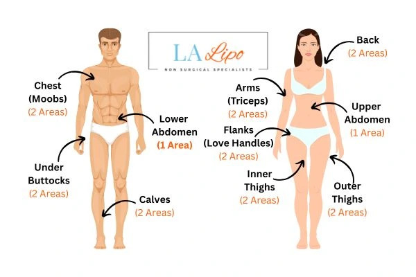 LA LIPO Cryolipolysis Areas Mansfield