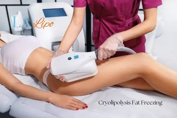 Woman receiving coolsculpting Mansfield treatment on her thighs