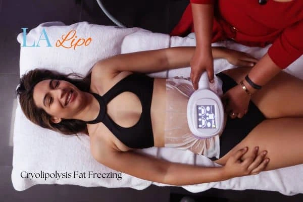 woman getting cryolipolysis Mansfield
