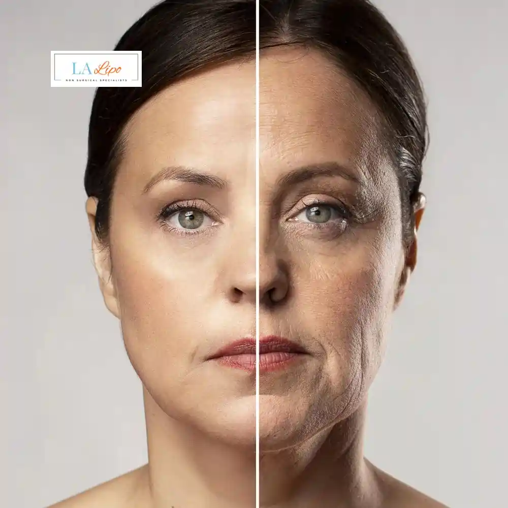 How Can You Tell If Non-Surgical Skin Tightening Is Right for You Mansfield?