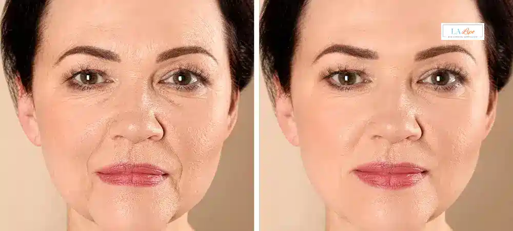 How Long Does It Take to See Results and How Long Do They Last Mansfield?