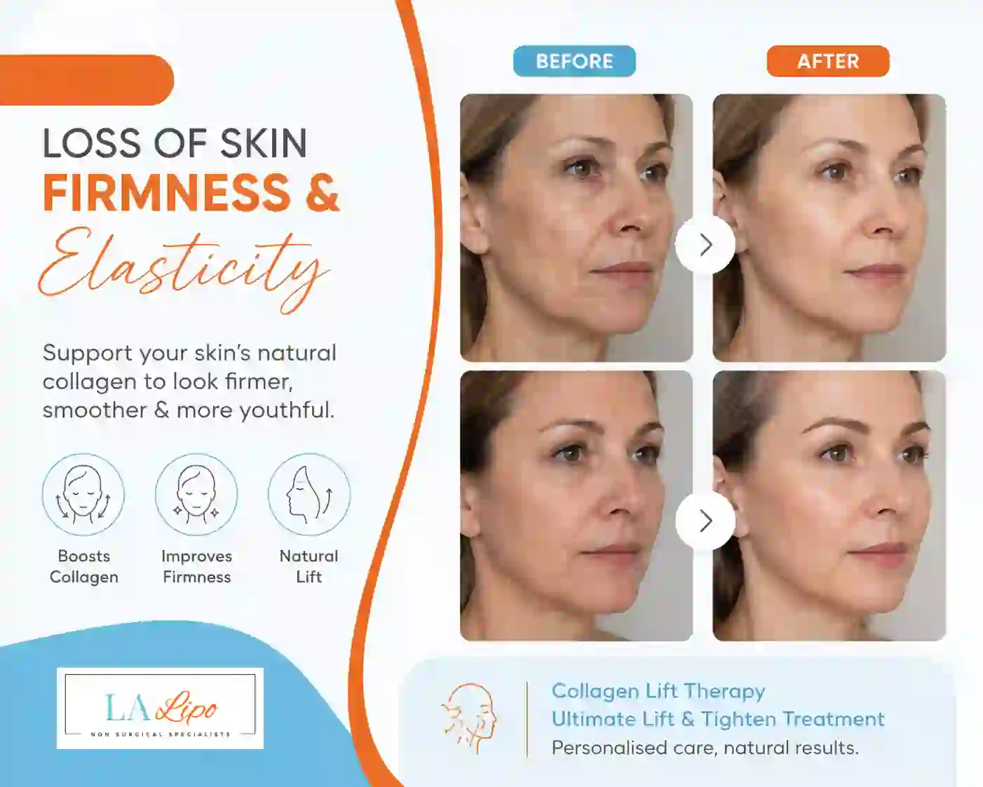Sign #7: Loss of Skin Firmness and Elasticity Mansfield